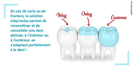 https://selarl-dr-simine-hassaneyn.chirurgiens-dentistes.fr/L'INLAY ou l'ONLAY