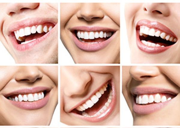 LA LIGNE DU SOURIRE