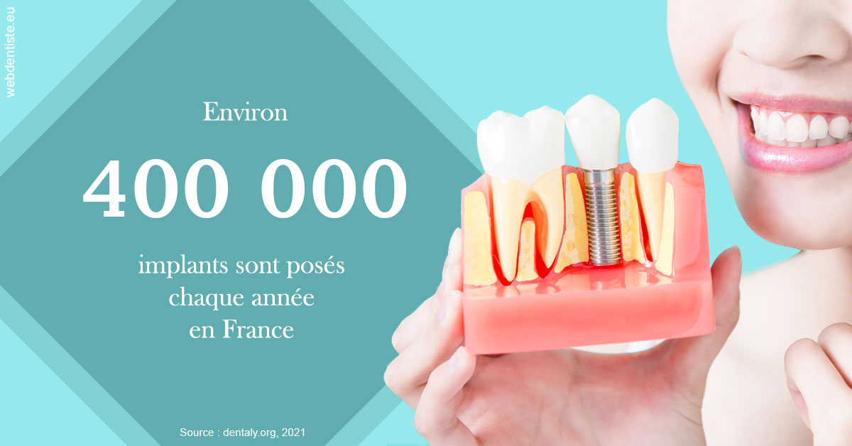 https://selarl-dr-simine-hassaneyn.chirurgiens-dentistes.fr/Pose d'implants en France 2