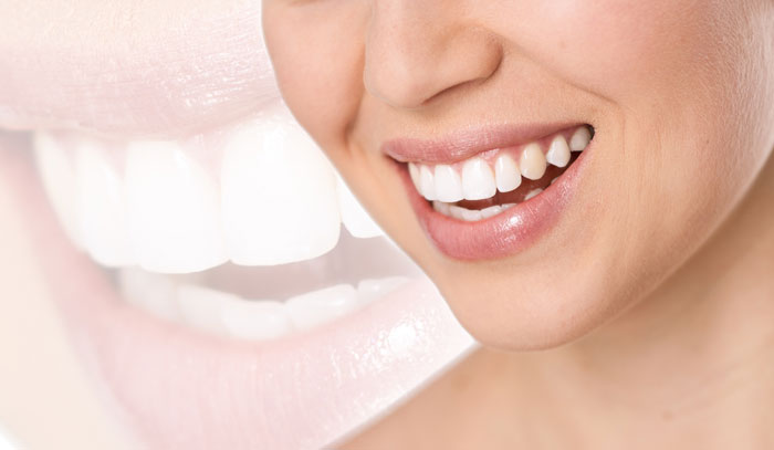 Sourire femme
